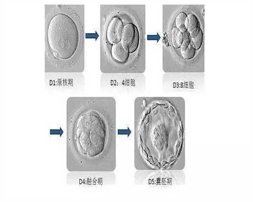 黑龙江怎么样捐卵,卵巢囊肿的常见预防方式是什么呢